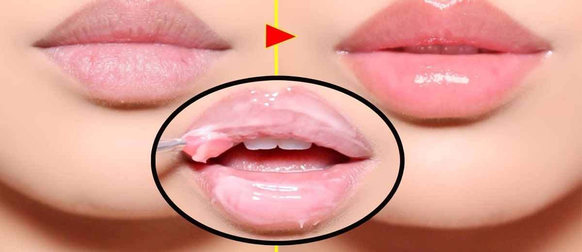 Natural ways to make your lips soft and chapped