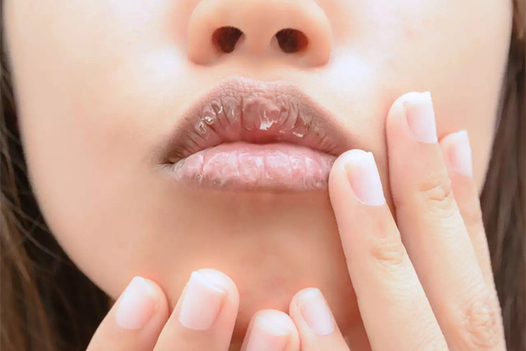 Natural ways to make your lips soft and chapped